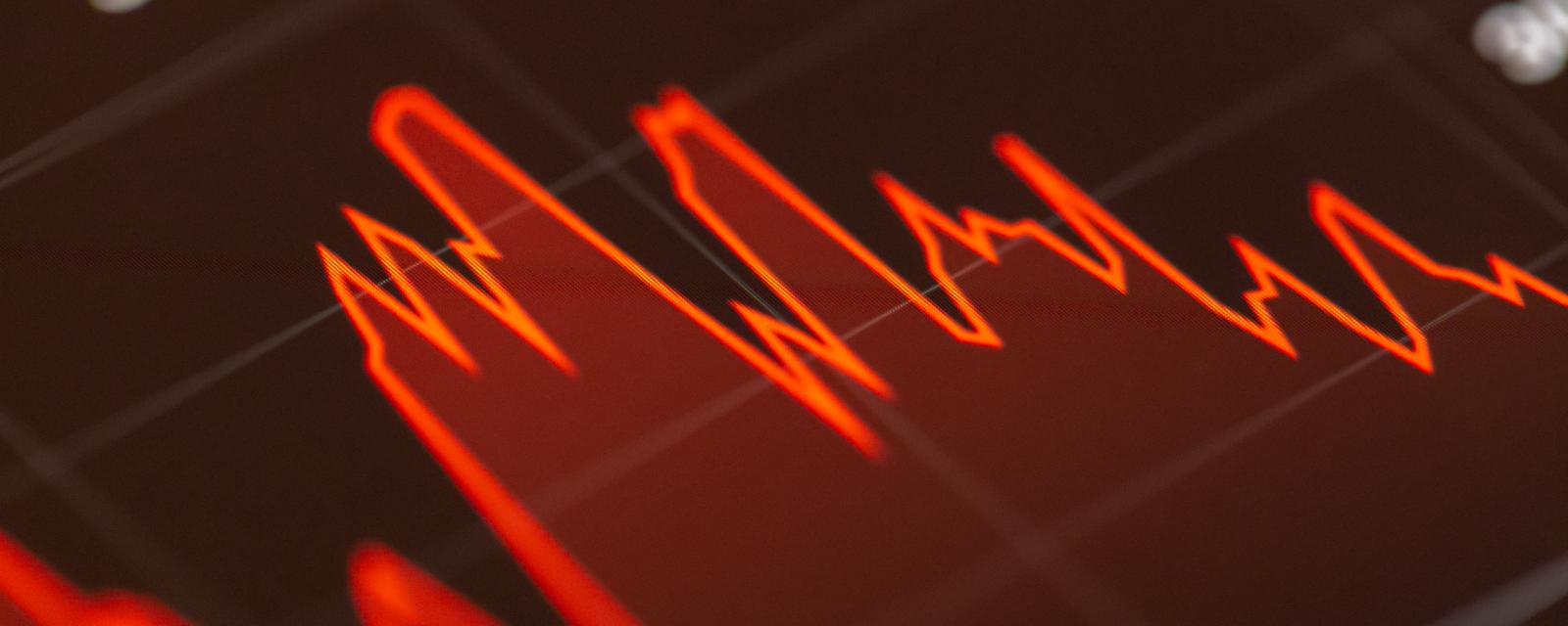 Regards croisés – 1 question, 3 experts : Comment saisir l’opportunité d’investir sur la volatilité actions ?